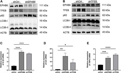 Oat beta-glucan reduces colitis by promoting autophagy flux in intestinal epithelial cells via EPHB6-TFEB axis